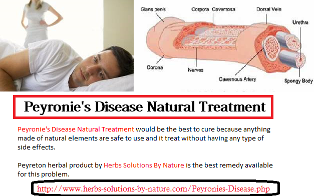 Peyronies Disease A Penile Deformity Herbs Solutions By Nature Blog