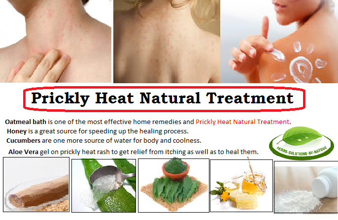 Herbal-Treatment-for-Prickly-Heat