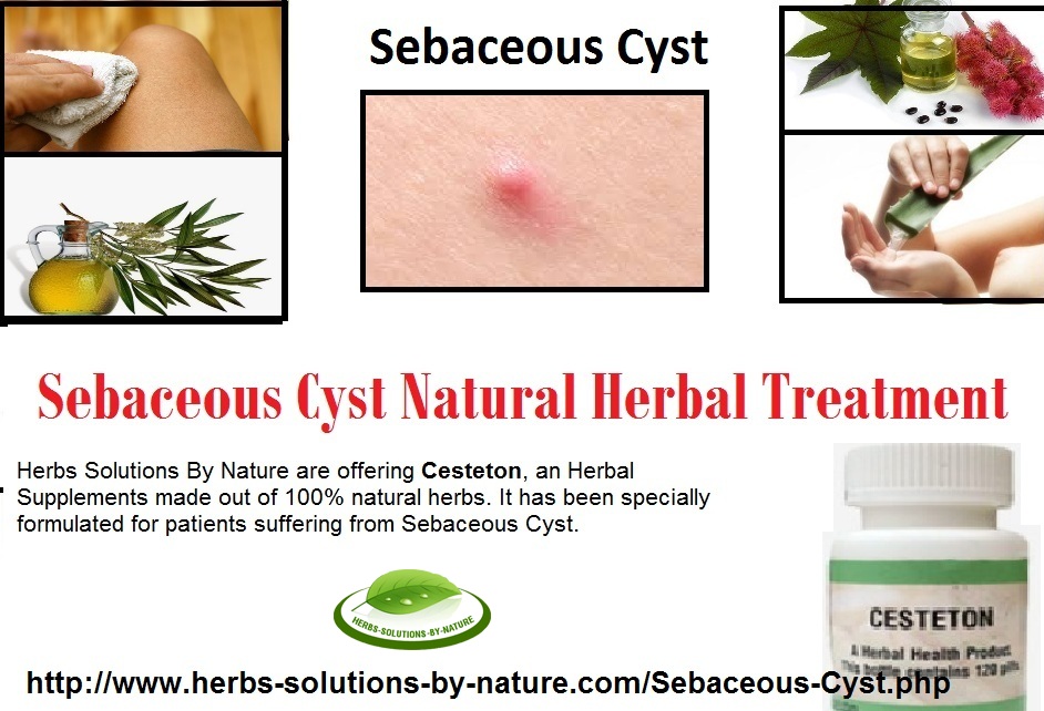 Herbal Treatment for Sebaceous Cyst help in reducing swelling and pain. 