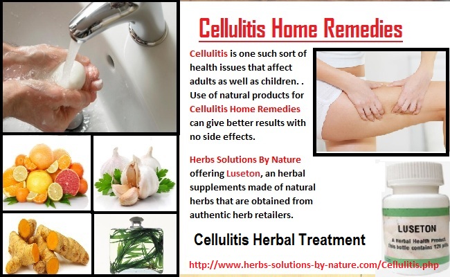 Cellulitis-Home-Remedies