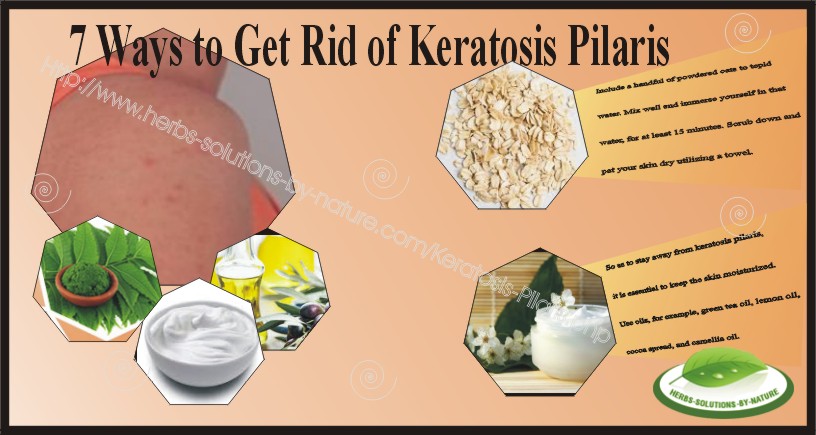 Natural-Treatment-for-Keratosis-Pilaris