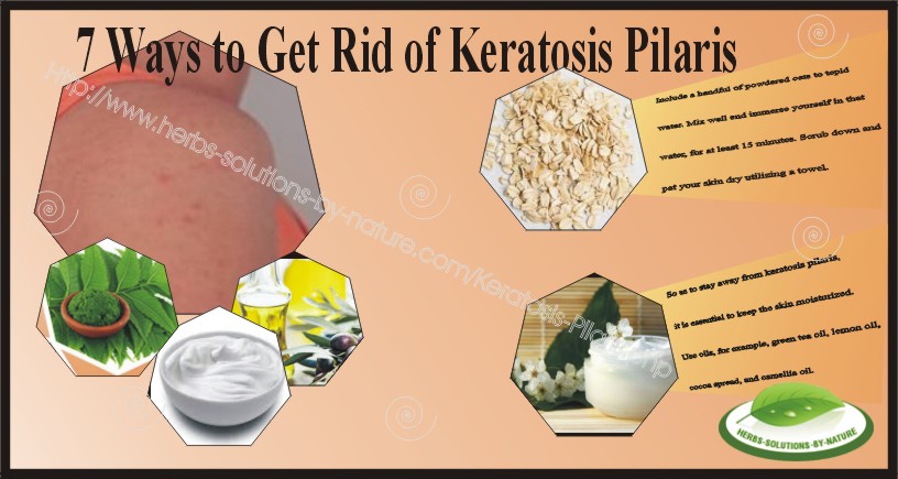 Ways To Get Rid Of Keratosis Pilaris Skin Disorder Herbs Solutions By Nature Blog