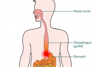 For Achalasia We Should Stick with Conventional Treatment