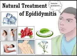 Epididymitis-Natural-Treatment