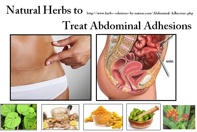 Abdominal-Adhesions