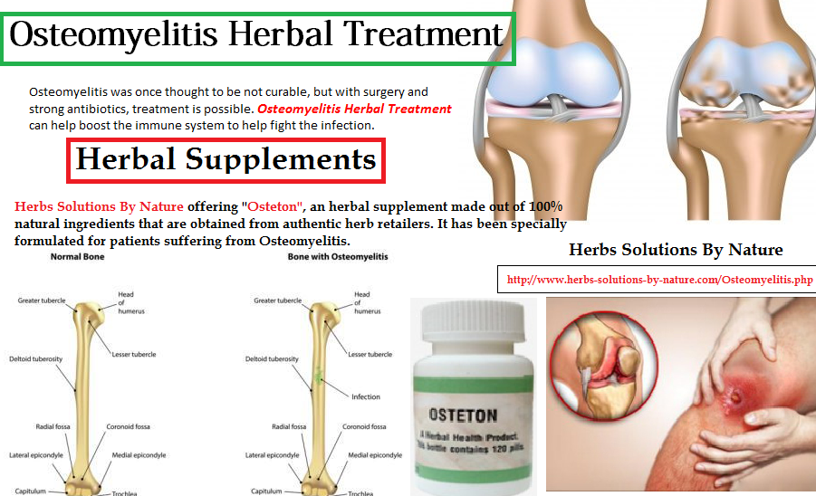 Osteomyelitis Herbal Treatment