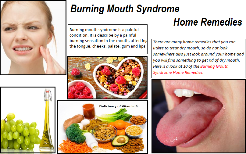 Home-Remedies-for-Burning-Mouth-Syndrome