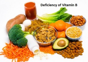 Deficiency of Vitamin B