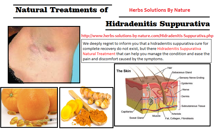 Hidradenitis-Suppurativa