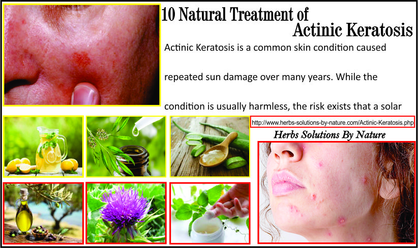 Natural-Treatment-of-Actinic-Keratosis