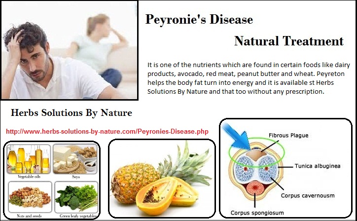 Some Of The Natural Ways Treat Peyronie S Disease Herbs Solutions By Nature Blog