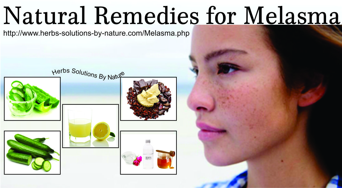 Natural-Remedies-for-Melasma