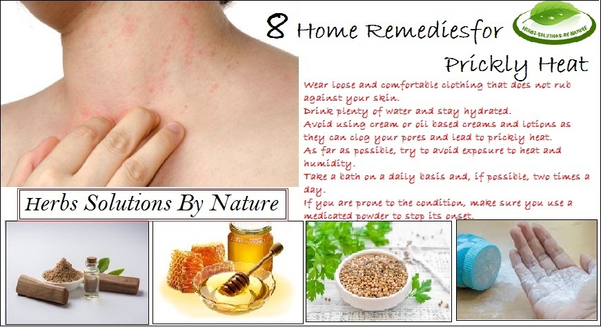 Home-Remedies-for-Prickly-Heat