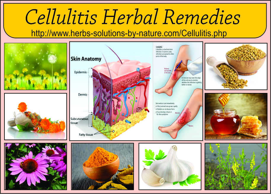 Herbal-Remedies-for-Cellulitis