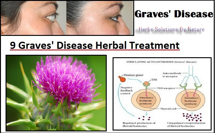 Graves'-Disease-Herbal-Treatment