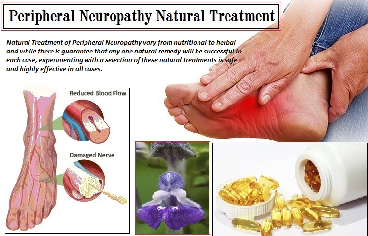 Natural-Treatment-for-Peripheral-Neuropathy