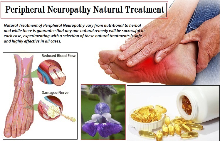 7 Natural Treatment Of Peripheral Neuropathy Herbs Solutions By Nature Blog 8612