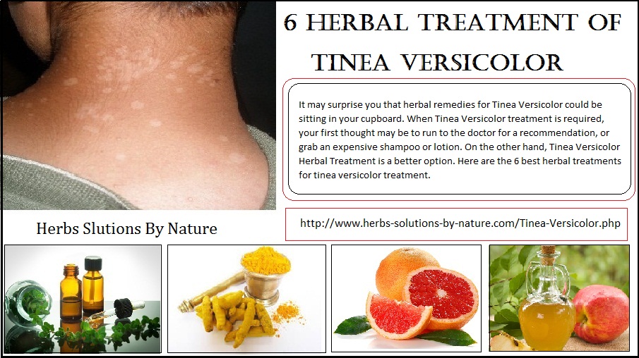 Tinea Versicolor: What It Is And How To Treat - Family Savvy