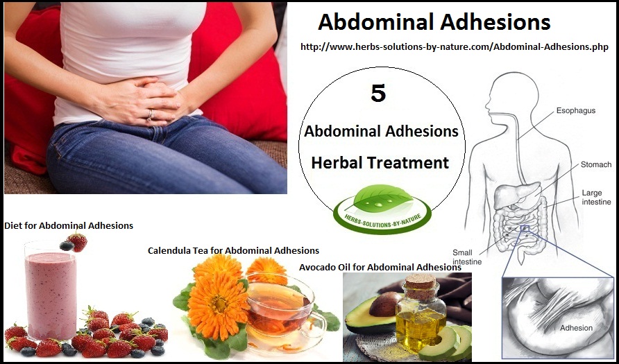 Abdominal Adhesions