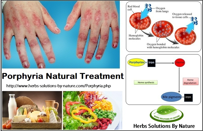 Natural-Treatment-for-Porphyria