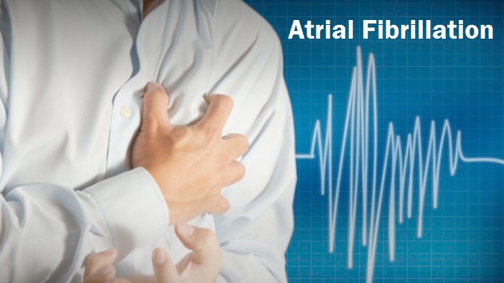 Atrial-Fibrillation