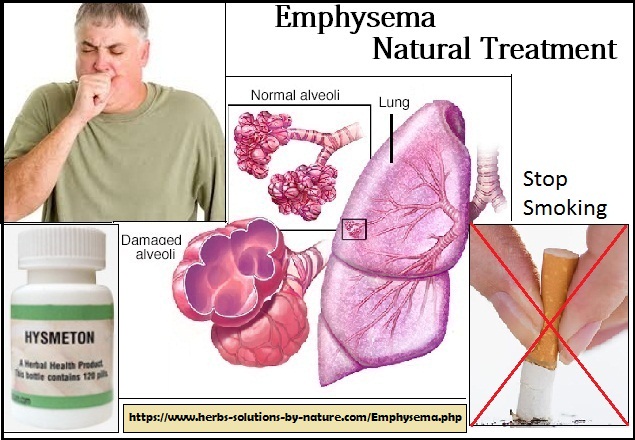 Emphysema-Natural-Treatment