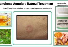 Greneton Herbal Supplement for Granuloma Annulare Natural Treatment