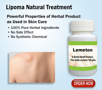 Lipoma-Natural-Treatment