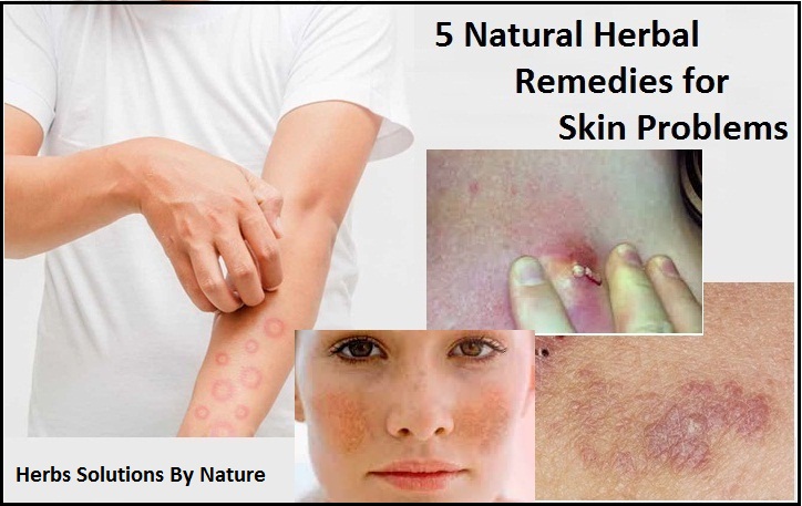 Herbal-Remedies-for-Skin-Problems