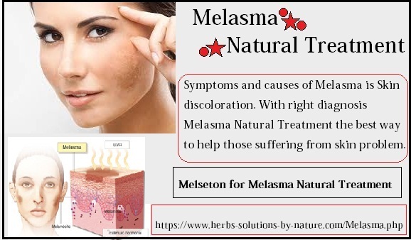 Melasma Natural Treatment