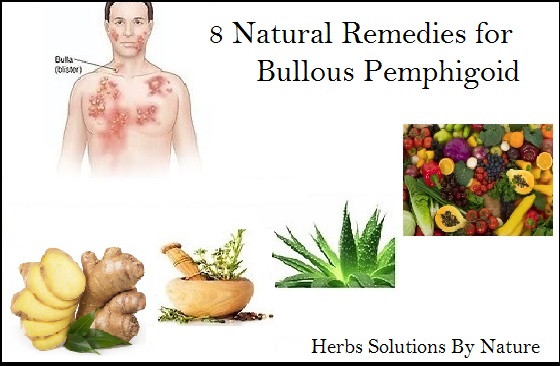 Natural-Remedies-for-Bullous-Pemphigoid