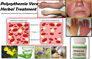 polycythemia