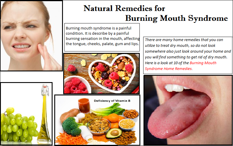Natural-Treatment-for-Burning-Mouth-Syndrome
