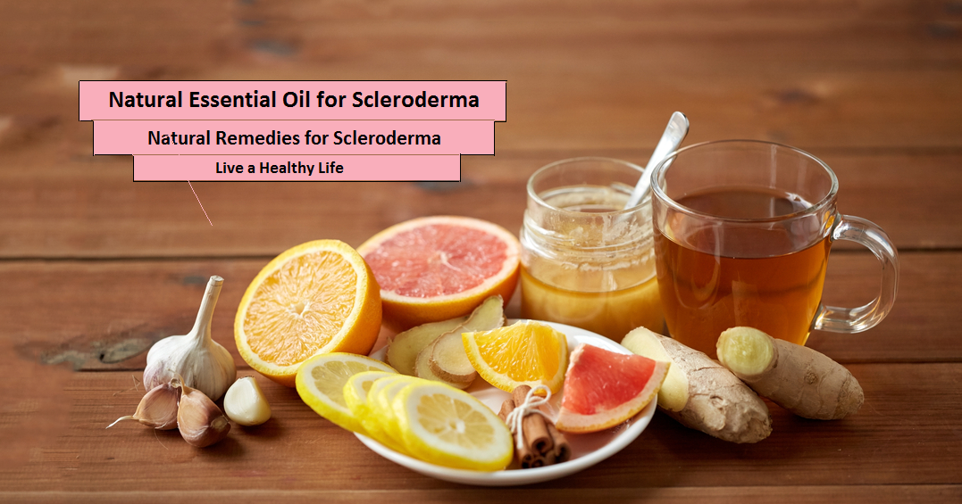 Natural-Remedies-for-Scleroderma
