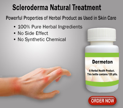 Scleroderma-Natural-Treatment
