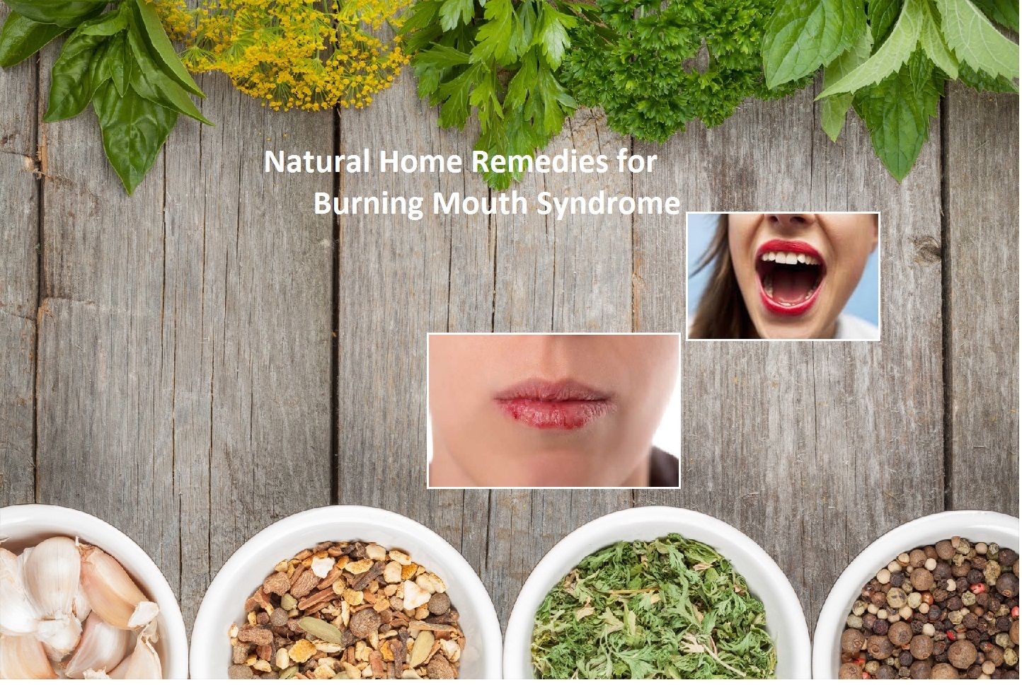 Natural-Home-Remedies-for-Burning-Mouth-Syndrome