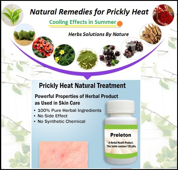 Natural-Treatment-for-Prickly-Heat