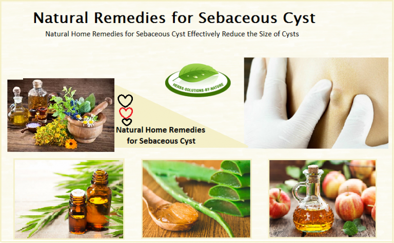 Natural Remedies For Sebaceous Cyst Effectively Reduce The Size Of Cysts Herbs Solutions By 