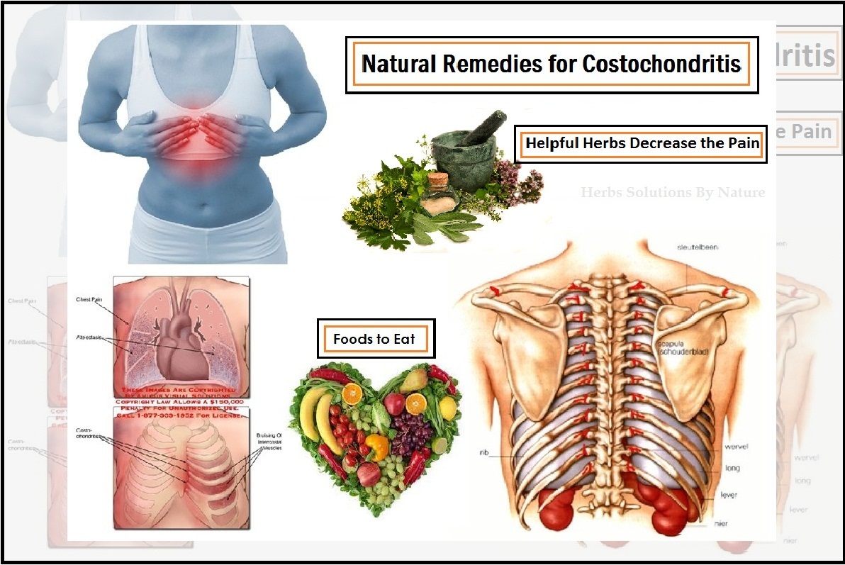 Costochondritis-Treatment-Natural-Remedies