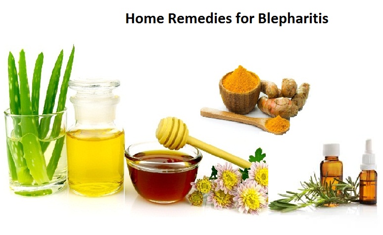 Home-Remedies-for-Blepharitis