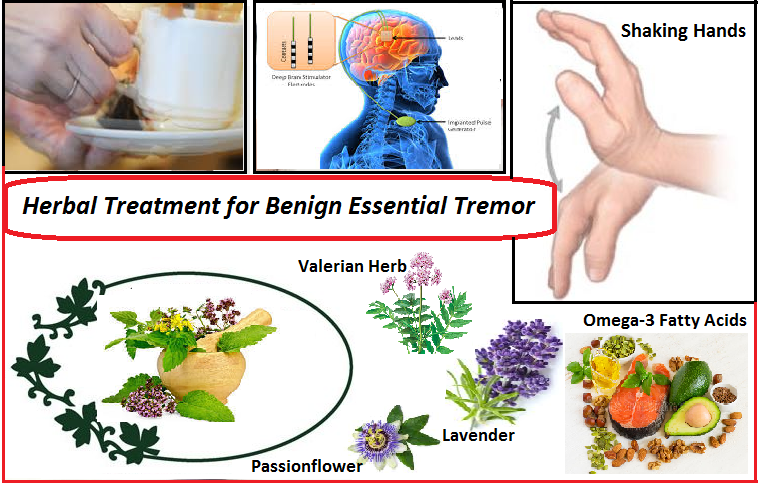 Herbal-Treatment-for-Benign-Essential-Tremor