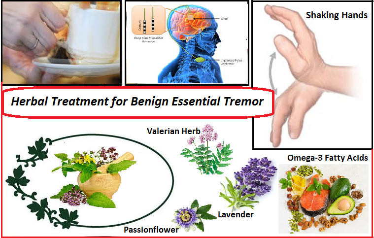 advances-in-treatments-of-essential-tremor