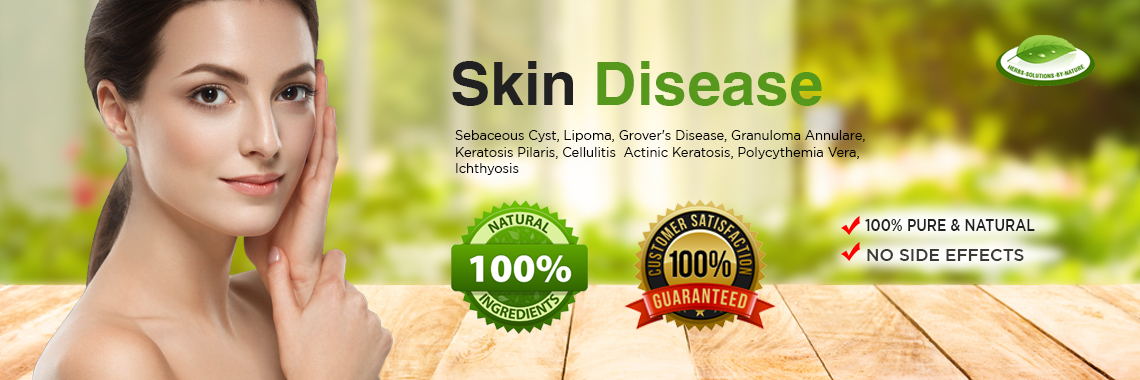 Top 13 General Skin Diseases And Conditions