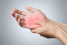 Top Treatments for Peripheral Neuropathy