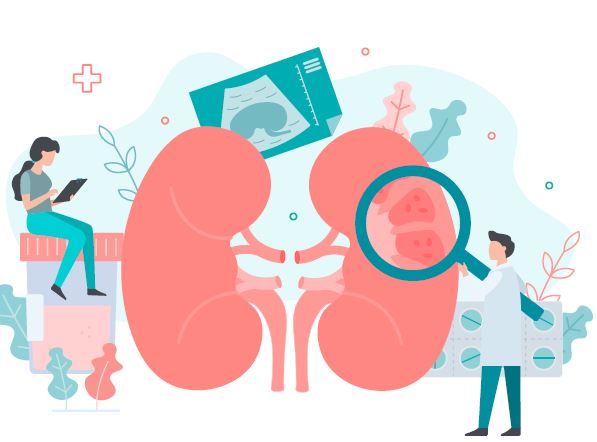 Ultimate Guide to Adult Polycystic Kidney Disease