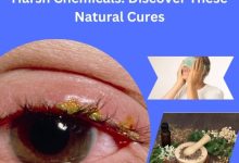 Blepharitis Treatment Without Harsh Chemicals