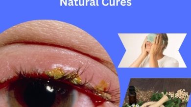 Blepharitis Treatment Without Harsh Chemicals