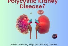 Can You Reverse Polycystic Kidney Disease