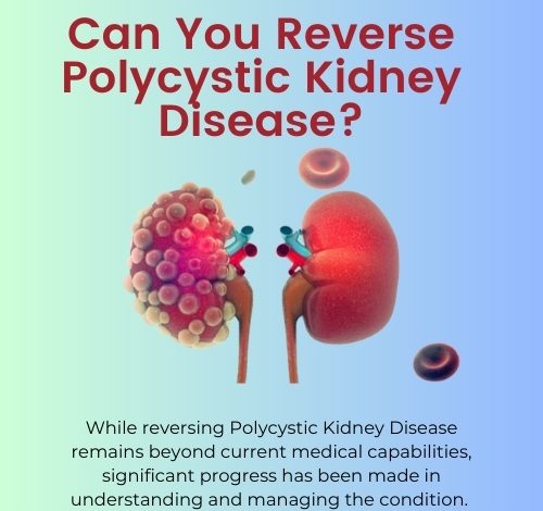 Can You Reverse Polycystic Kidney Disease